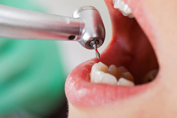 Best Emergency Treatment for Oral Infections in Sauk City, WI